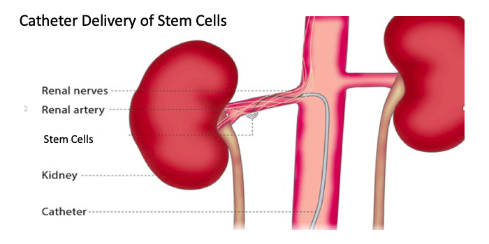 Chronic kidney disease